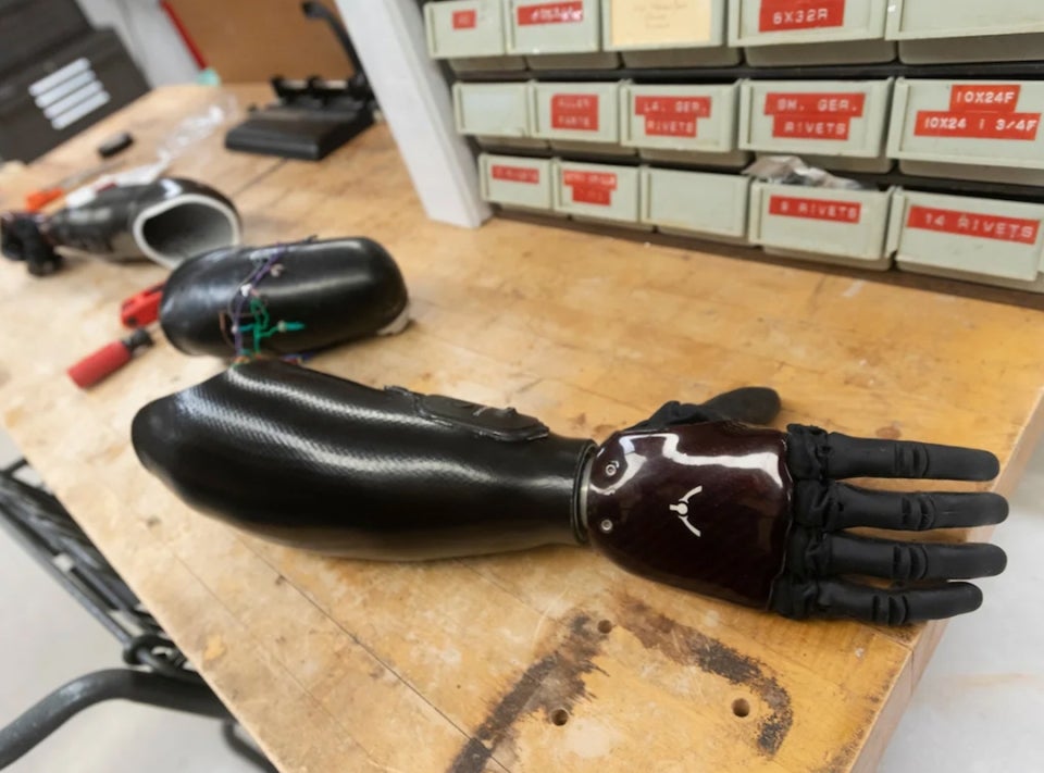 One of the newer myoelectric prosthetic hands sits on a workshop table at UC Davis Health.