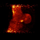 Pet scan 
