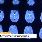 Brain scan images